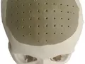 post_big/oxfordskull_implant_610x801.jpg