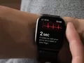 Пользователи Apple Watch в Украине с обновлением watchOS 7.6 получили поддержку ЭКГ