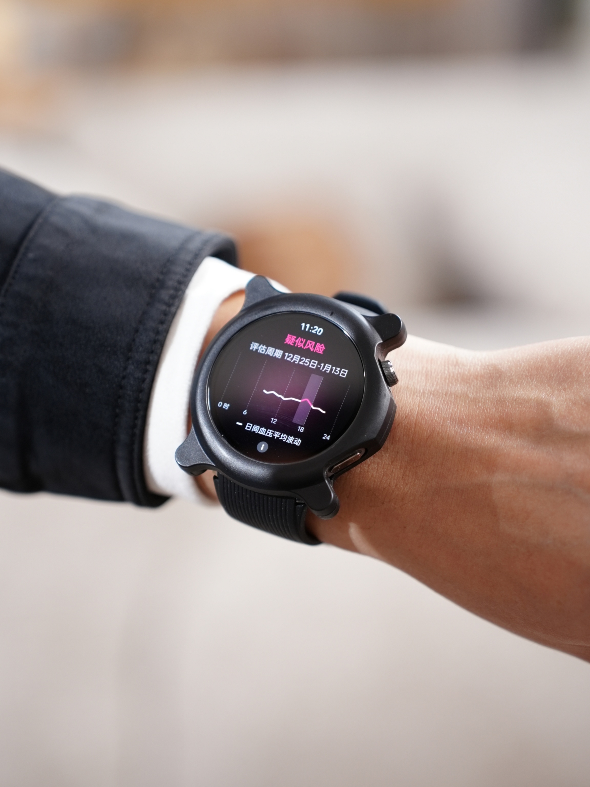 Новий годинник Oppo Watch X2 у захисному кейсі