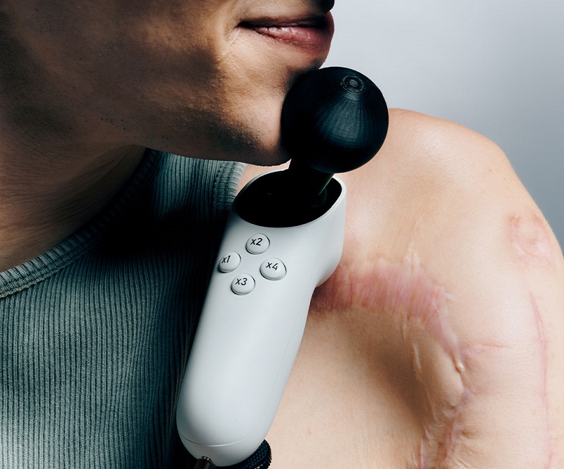 Грати стане простіше: Microsoft презентувала пристрій Xbox Adaptive Joystick, сумісний з Xbox, PC, Android та iOS, для людей з обмеженими можливостями-2