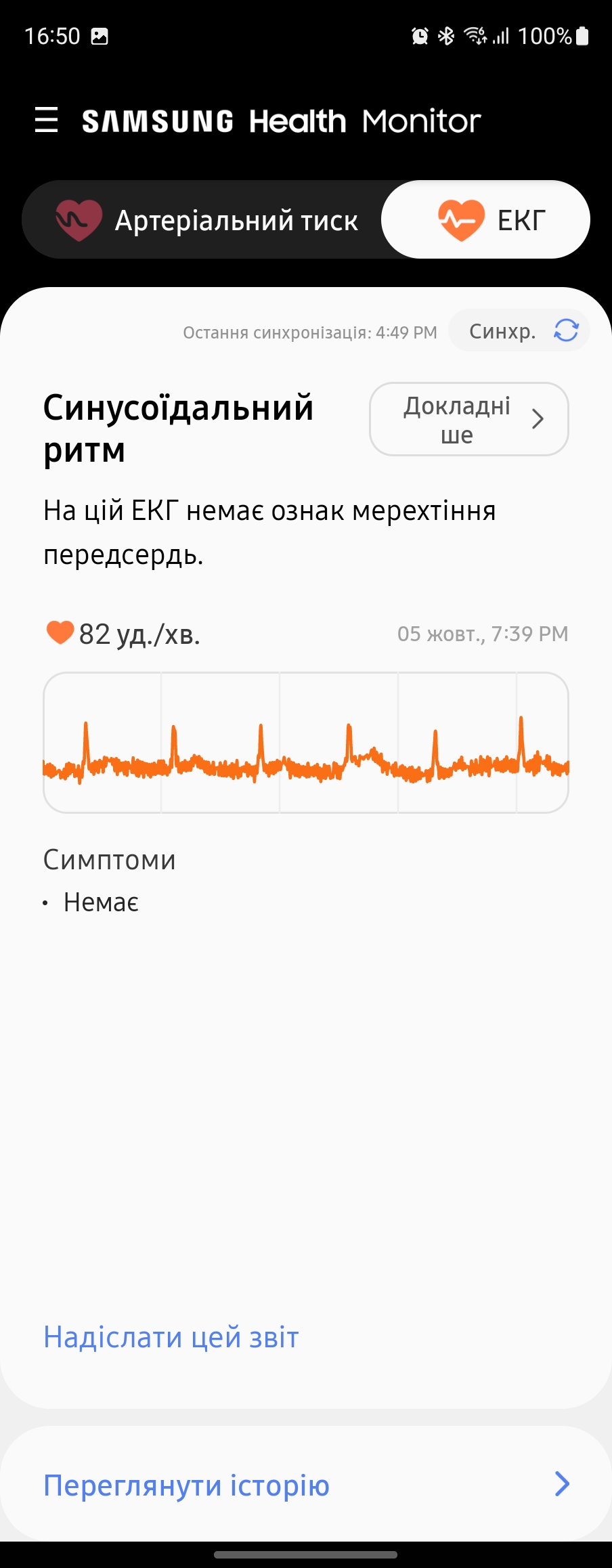 Обзор Samsung Galaxy Watch5 Pro и Watch5: плюс автономность, минус физический безель-228