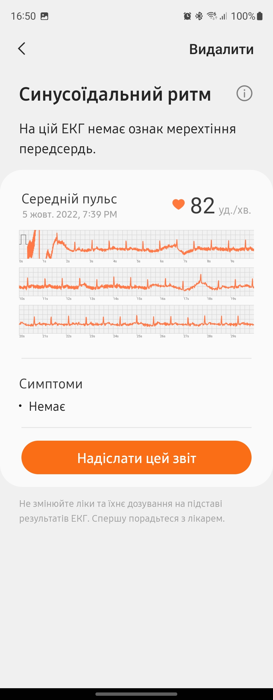 Обзор Samsung Galaxy Watch5 Pro и Watch5: плюс автономность, минус физический безель-229