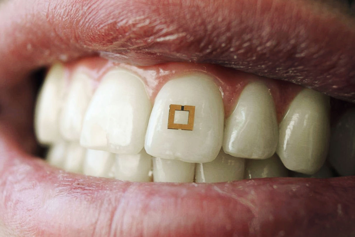 teeth.jpg