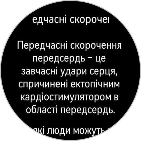 Победитель паники: обзор смарт-часов Huawei Watch GT 6 Pro Watch GT 6 Pro-176